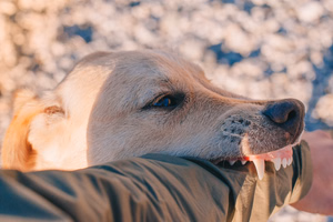 dog-biting-arm