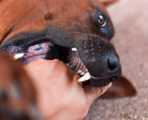 dog-biting-hands