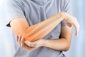 post-traumatic-arthritis