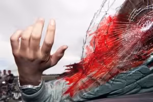 Orange County car accident attorney